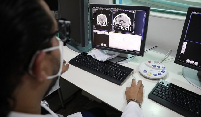 IMSS promueve salud cerebral con acciones de prevención