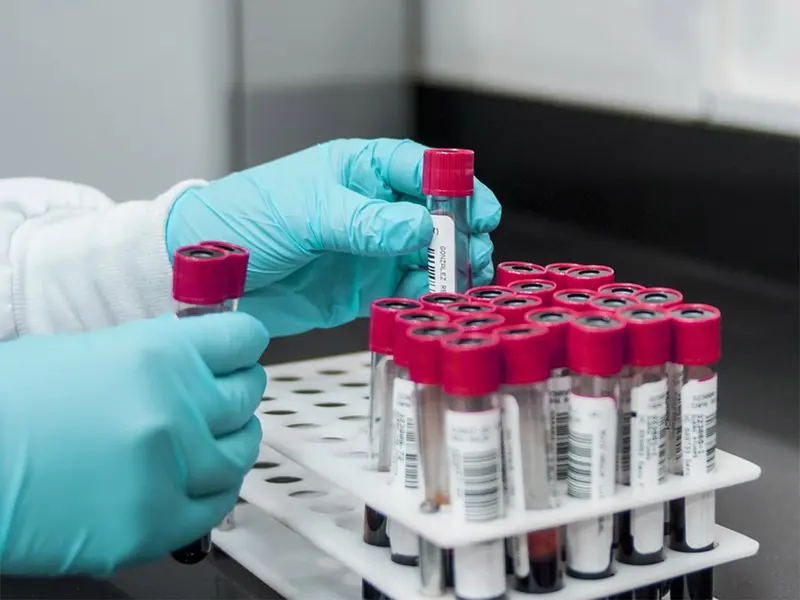 Tener niveles superiores de azúcar en la sangre incrementa el riesgo de morir