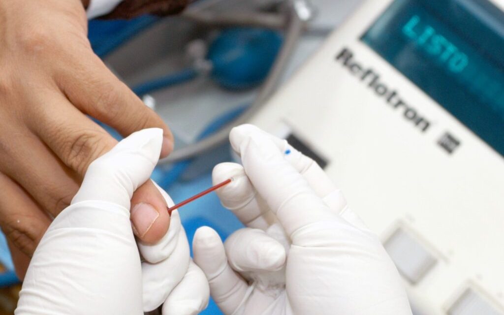 IMSS brinda tratamiento a mujeres con ovario poliquístico