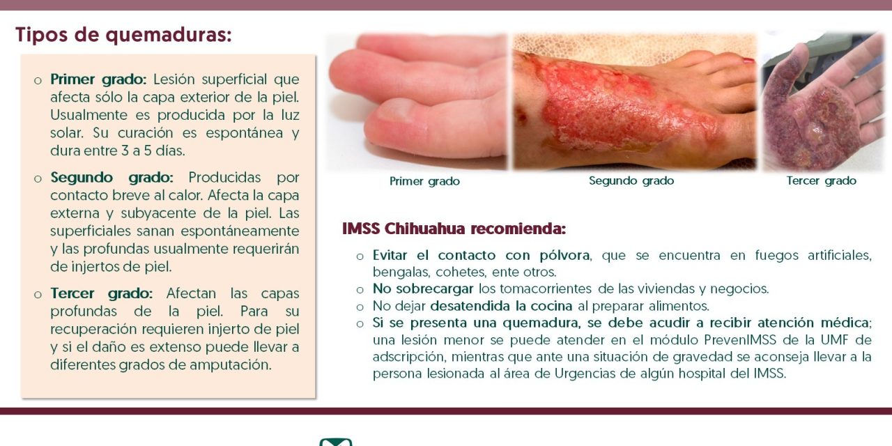 Exhorta IMSS a cuidados por quemaduras a causa de fuegos artificiales