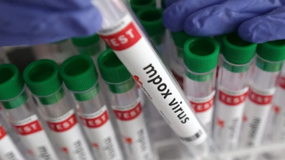China detecta brote de la nueva variante de mpox; reporta que síntomas de los pacientes son leves
