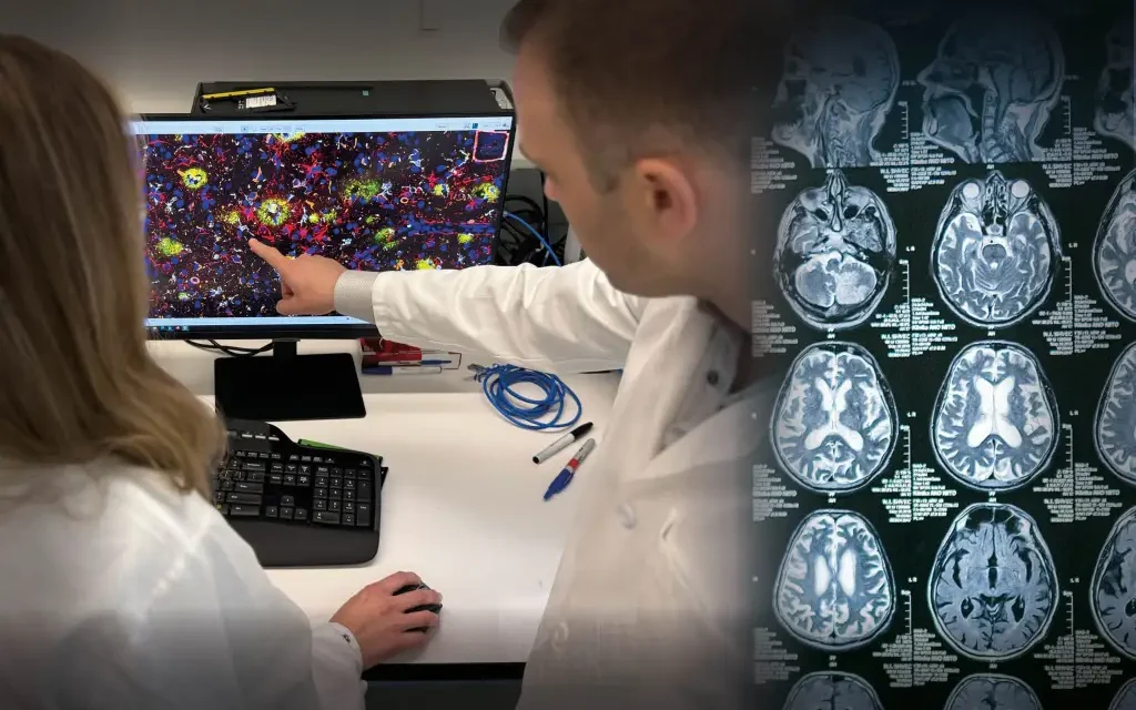 La vacuna para el Alzheimer podría estar en nuestro cerebro