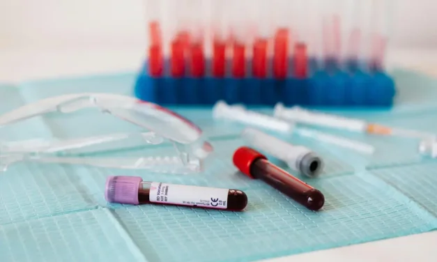 Logran detectar alzheimer con análisis de sangre