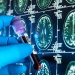 Autorizan primera prueba de sangre para diagnóstico de Alzheimer