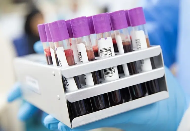 Ansiedad, aislamiento y empleo en riesgo: la cara oculta de la hemofilia