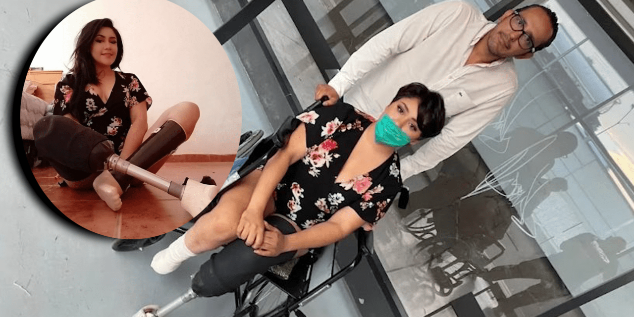 «Fui retirarme el DIU y me amputaron las piernas», así perdió Vanessa Dib sus extremidades