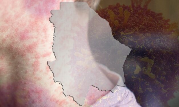 Sarampión deja 21 defunciones en el Estado de Chihuahua